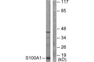 Western Blotting (WB) image for anti-S100 Calcium Binding Protein A1 (S100A1) (N-Term) antibody (ABIN1848767) (S100A1 Antikörper  (N-Term))