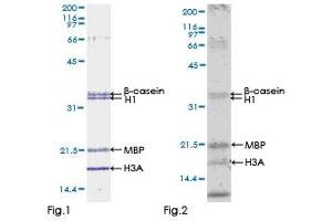 Kinase Activity Assay (KAA) image for Bone Morphogenetic Protein Receptor, Type IB (BMPR1B) (AA 14-502) protein (GST tag) (ABIN1346785) (BMPR1B Protein (AA 14-502) (GST tag))