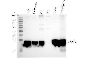 anti-Fatty Acid Binding Protein 1, Liver (FABP1) (AA 6-36), (N-Term) antibody