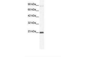Image no. 1 for anti-Minichromosome Maintenance Deficient 4 (MCM4) (C-Term) antibody (ABIN203262) (MCM4 Antikörper  (C-Term))