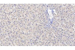 Detection of MAPRE1 in Human Liver Tissue using Monoclonal Antibody to Microtubule Associated Protein RP/EB Family, Member 1 (MAPRE1) (MAPRE1 Antikörper  (AA 2-268))