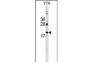 DNAJC5 Antibody (Center) (ABIN1538465 and ABIN2849241) western blot analysis in Y79 cell line lysates (35 μg/lane). (DNAJC5 Antikörper  (AA 52-80))