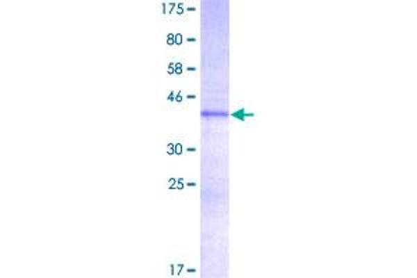 HMGA1 Protein (AA 1-96) (GST tag)