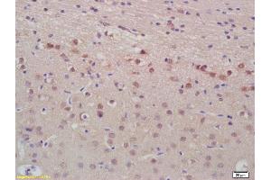 Formalin-fixed and paraffin embedded rat brain labeled with Anti-ANP Polyclonal Antibody, Unconjugated (ABIN676928) at 1:200, followed by conjugation to the secondary antibody and DAB staining (NPPA Antikörper  (AA 124-151))