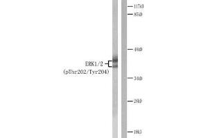 Western blot analysis of extracts from Jurkat cells treated with PMA. (ERK1/2 Antikörper  (pThr202, pTyr204))