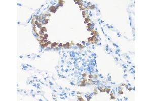 Immunohistochemistry of paraffin-embedded Mouse lung using FGF10 Polyclonal Antibody at dilution of 1:100 (40x lens). (FGF10 Antikörper)