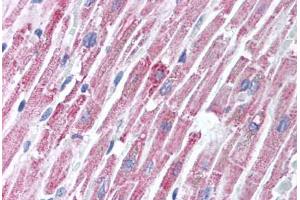 Human Heart (formalin-fixed, paraffin-embedded) stained with TIRAP antibody ABIN213995 at 2 ug/ml followed by biotinylated goat anti-rabbit IgG secondary antibody ABIN481713, alkaline phosphatase-streptavidin and chromogen. (TIRAP Antikörper  (C-Term))