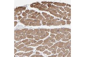 Immunohistochemical staining of human heart muscle with CCDC80 polyclonal antibody  shows moderate cytoplasmic positivity in myocytes at 1:50-1:200 dilution. (CCDC80 Antikörper)