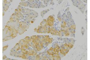 ABIN6276778 at 1/100 staining Human pancreas tissue by IHC-P. (IDE Antikörper  (N-Term))