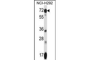 SLC41A2 Antibody (N-term) (ABIN657753 and ABIN2846735) western blot analysis in NCI- cell line lysates (35 μg/lane). (SLC41A2 Antikörper  (N-Term))