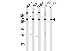 All lanes : Anti-PKM2 antibody at 1:2000 dilution Lane 1: MCF-7 whole cell lysates Lane 2: Hela whole cell lysates Lane 3: THP-1 whole cell lysates Lane 4: NIH/3T3 whole cell lysates Lane 5: PC-12 whole cell lysates Lysates/proteins at 20 μg per lane. (PKM2 Antikörper  (N-Term))