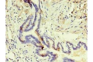Immunohistochemistry of paraffin-embedded human lung using ABIN7140933 in 30 μg/mL dilute concentrations. (CD14 Antikörper)