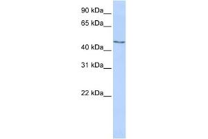WB Suggested Anti-MECP2 Antibody Titration:  0. (MECP2 Antikörper  (Middle Region))