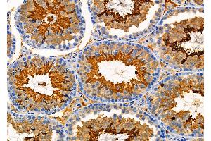 ABIN6265691 and ABIN6276606 at 1/100 staining Mouse testis tissue by IHC-P. (TPM3 Antikörper  (N-Term))