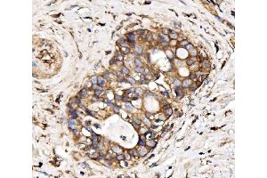 IHC analysis of IRBIT/AHCYL1 using anti-IRBIT/AHCYL1 antibody (ABIN7600030).
