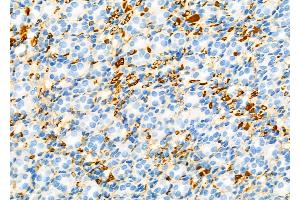 ABIN6257051 and ABIN6274616 at 1/100 staining Rat kidney tissue by IHC-P.