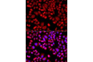 Immunofluorescence analysis of A549 cells using ARPC3 antibody. (ARPC3 Antikörper)