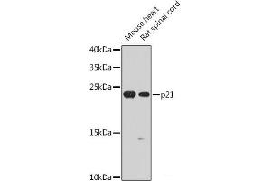 Western blot analysis of extracts of various cell lines using p21 Polyclonal Antibody at dilution of 1:1000. (p21 Antikörper)