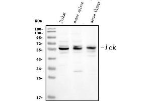 Western blot analysis of Lck using anti-Lck antibody (ABIN3043870). (LCK Antikörper  (C-Term))