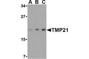 Western blot analysis of TMP21 in mouse brain tissue lysate with this product at (A) 0. (TMED10 Antikörper  (Center))
