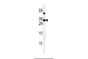 Western blot analysis of ZCH24 Antibody (C-term) (ABIN651036 and ABIN2840043) in CHO cell line lysates (35 μg/lane). (ZCCHC24 Antikörper  (C-Term))