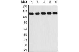 Western blot analysis of RANBP5 expression in SW620 (A), Hela (B), HepG2 (C), mouse heart (D), mouse brain (E) whole cell lysates. (Importin 5 Antikörper)