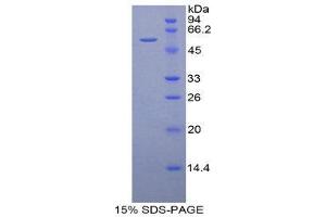 SDS-PAGE (SDS) image for Duffy Blood Group, Chemokine Receptor (DARC) (AA 71-330) protein (His tag,GST tag) (ABIN1878963)