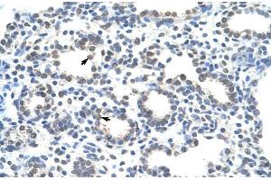 Human Lung; ZRANB2 antibody - middle region in Human Lung cells using Immunohistochemistry (ZNF265 Antikörper  (Isoform 2, Middle Region))