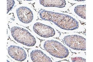 IHC analysis of COMT using anti-COMT antibody (ABIN7601948). (COMT Antikörper  (AA 52-271))