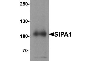 Western blot analysis of SIPA1 in human brain tissue lysate with SIPA1 antibody at 1 µg/mL. (SIPA1 Antikörper  (N-Term))