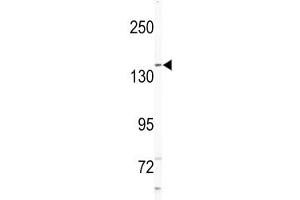 Western blot analysis of NIK antibody and Jurkat lysate. (MAP4K4 Antikörper  (AA 618-649))