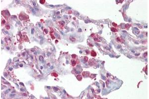 Anti-FOSL1 / FRA1 antibody IHC staining of human lung. (FOSL1 Antikörper  (AA 143-192))