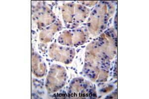 CES8 Antibody (C-term) (ABIN656888 and ABIN2846087) immunohistochemistry analysis in formalin fixed and paraffin embedded human stomach tissue followed by peroxidase conjugation of the secondary antibody and DAB staining. (CES4A Antikörper  (C-Term))