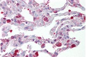 Immunohistochemistry with Lung tissue at an antibody concentration of 5µg/ml using anti-FOSL1 antibody (ARP31378_P050) (FOSL1 Antikörper  (Middle Region))