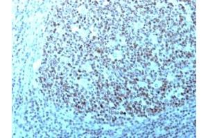 Formalin-fixed, paraffin-embedded human tonsil stained with Nucleolin antibody.