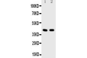 Observed bind size: 42KD (HDAC8 Antikörper  (N-Term))