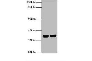 Western Blotting (WB) image for anti-Major Histocompatibility Complex, Class II, DR beta 1 (HLA-DRB1) (AA 30-266) antibody (ABIN6068471)