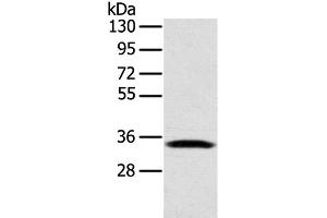 Western Blot analysis of Mouse lung tissue using STX11 Polyclonal Antibody at dilution of 1:400 (Syntaxin 11 Antikörper)