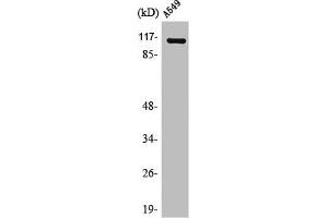 Western Blot analysis of HuvEc cells using Liprin β1 Polyclonal Antibody (PPFIBP1 Antikörper  (Internal Region))
