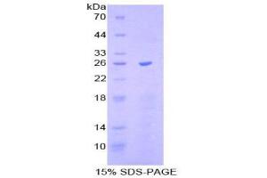 SDS-PAGE (SDS) image for SR-Related CTD-Associated Factor 11 (SCAF11) (AA 969-1165) protein (His tag) (ABIN1878834)