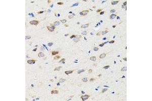Immunohistochemistry (IHC) image for anti-E3 Ubiquitin-Protein Ligase SIAH1 (SIAH1) (AA 1-313) antibody (ABIN3016132)