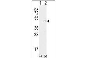 Western blot analysis of SET9(arrow) using rabbit polyclonal SET9 Antibody (ABIN387997 and ABIN2845289). (SETD7 Antikörper  (AA 159-189))