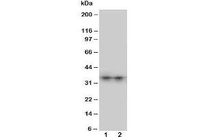Western blot testing of Aquaporin 8 antibody and Lane 1:  SW620;  2: COLO320 cell lysate. (Aquaporin 8 Antikörper  (N-Term))