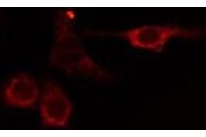 ABIN6275049 staining HuvEc cells by IF/ICC. (AGBL2 Antikörper  (C-Term))