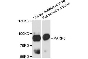 Western blot analysis of extracts of various cell lines, using PARP8 antibody. (PARP8 Antikörper)