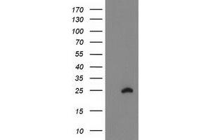 Western Blotting (WB) image for anti-Family With Sequence Similarity 119A (FAM119A) antibody (ABIN1498599) (FAM119A Antikörper)