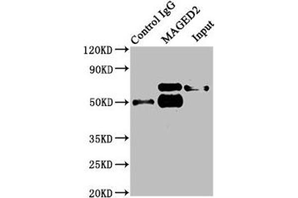 MAGED2 Antikörper  (AA 38-285)