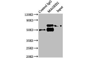 Immunoprecipitating MAGED2 in HepG2 whole cell lysate Lane 1: Rabbit control IgG instead of ABIN7159296 in HepG2 whole cell lysate. (MAGED2 Antikörper  (AA 38-285))