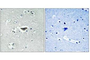 Immunohistochemical analysis of paraffin-embedded human brain tissue using Ras-GRF1 (Phospho-Ser916) antibody (left)or the same antibody preincubated with blocking peptide (right). (RASGRF1 Antikörper  (pSer916))