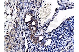 Formalin-fixed and paraffin-embedded : rat ovary tissue labeled with Rabbit Anti-APELIN RECEPTOR Polyclonal Antibody, Unconjugated (ABIN740160) 1:200 followed by conjugation to the secondary antibody and DAB staining (Apelin Receptor Antikörper  (AA 52-66))